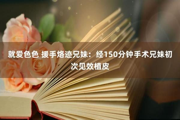 就爱色色 援手烙迹兄妹：经150分钟手术兄妹初次见效植皮